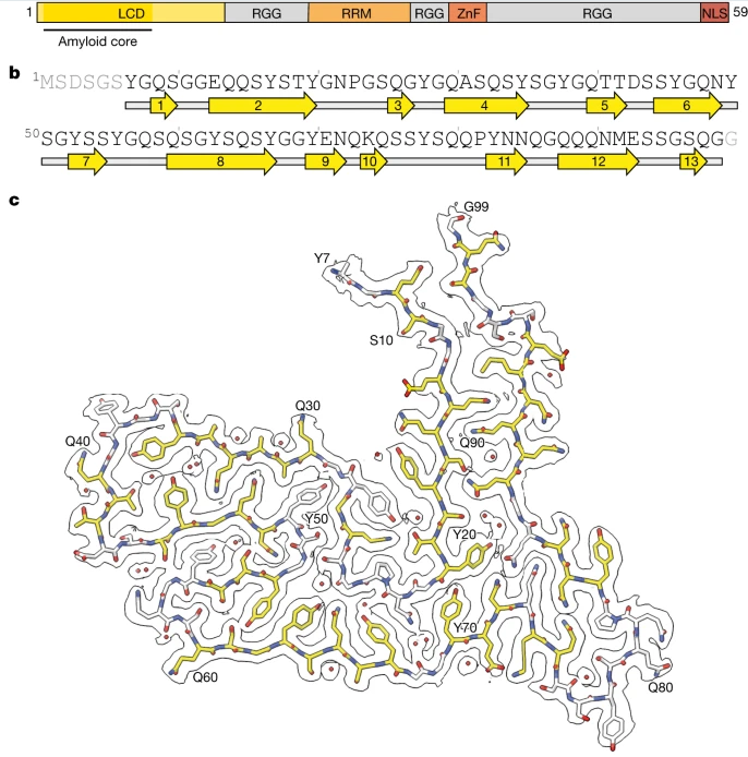 Nature：科學(xué)家識別出與人類額顳葉癡呆癥發(fā)生相關(guān)的新型蛋白質(zhì)